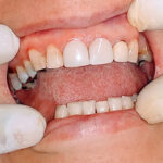 AF1QipM98c46B JSeqJKaxmlwFiHHDgULwFnggMgpgirw408 h306 k no