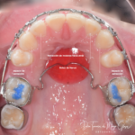 AF1QipMA 7f CKMyVNt9u bFF Y9veO6iXkw46NzKJV w408 h403 k no