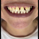 AF1QipMR8yUhsLjWAFg JnY56cAnN7H9jpEJ4GgoOoHcw408 h723 k no