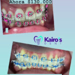 AF1QipMsHU7RHPekpRUKzNaER4R6LEh9fTS64c4A7hgnw408 h725 k no