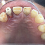 AF1QipNovrzMdp0mubb0OHZr30uhNWpwyQlDUnY sIDFw408 h300 k no