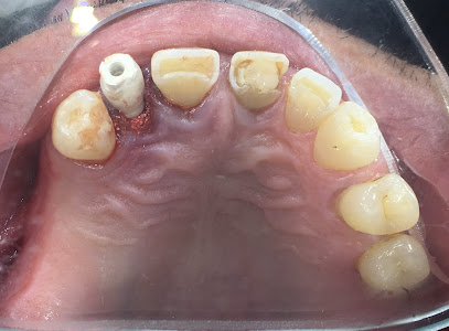 AF1QipNovrzMdp0mubb0OHZr30uhNWpwyQlDUnY sIDFw408 h300 k no