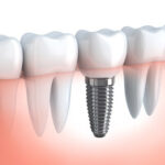 AF1QipNtGdVCSnrII47DOczCRM ZfwUNZbB13BELQXkpw408 h278 k no