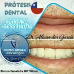 AF1QipObQB0DdcCJFy28XyZkaBLEvotrbqkE7VJ BwEpw408 h734 k no