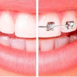 AF1QipOhHOQPGCG700xawe21FO7WEjXVu1dfWIYJri76w457 h240 k no