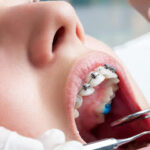 AF1QipOsN9sqnHvcNEGLWYZbN1qyYMv5rLROs6Z6GL1ww426 h240 k no