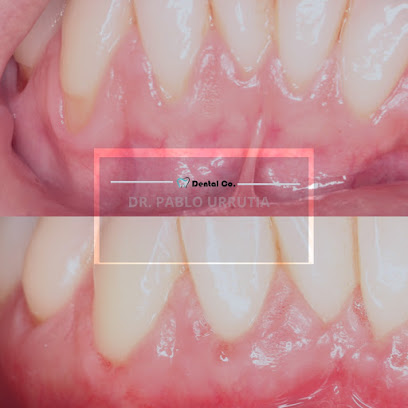 AF1QipPZeAka0BgpNUqnw8myafngMs 5s8ZwC0f87kIw408 h408 k no