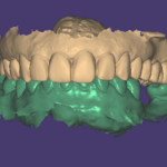 AF1QipPjWagn6XEalfQgVAInCslz7wfF6I5O7GYlcXLpw408 h245 k no