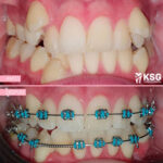 AF1QipPq87DWIcMkxZga8ApVVYQ9ZB9LYvHf YVE2WmIw408 h409 k no